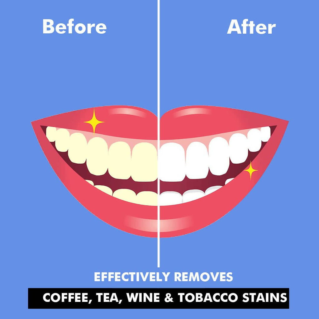 Perfora Teeth Whitening Powder | Grocsy