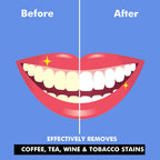 Perfora Teeth Whitening Powder | Grocsy