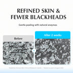 Eqqualberry Swimming Pool Toner 5 Berry Complex & Hyaluronic Acid,Pore Refining & Gentle Exfoliation | Grocsy