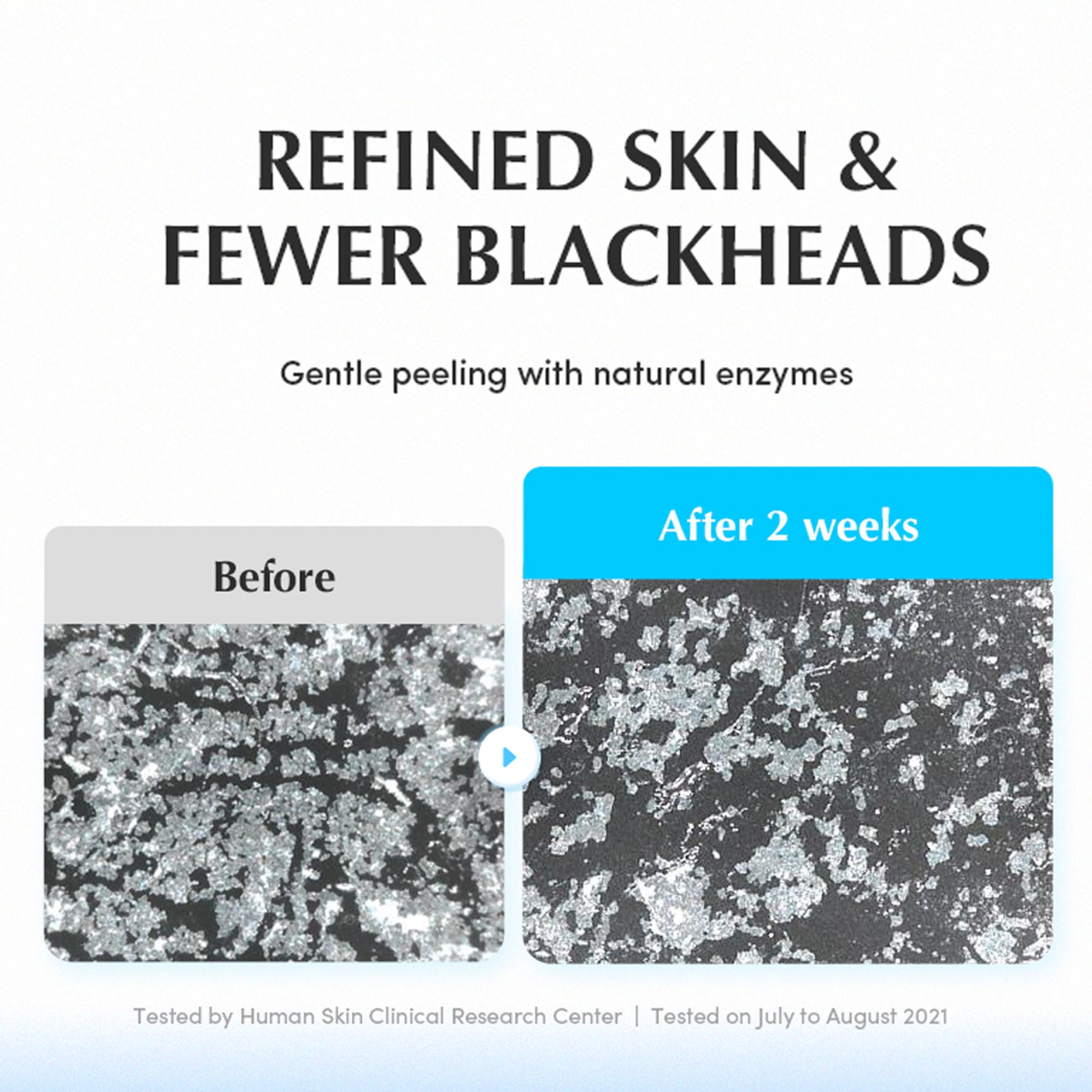 Eqqualberry Swimming Pool Toner 5 Berry Complex & Hyaluronic Acid,Pore Refining & Gentle Exfoliation | Grocsy