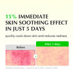 Eqqualberry Aloe PDRN Calming Serum – Cica, Hydrating & Soothing Sensitive Skin | Grocsy