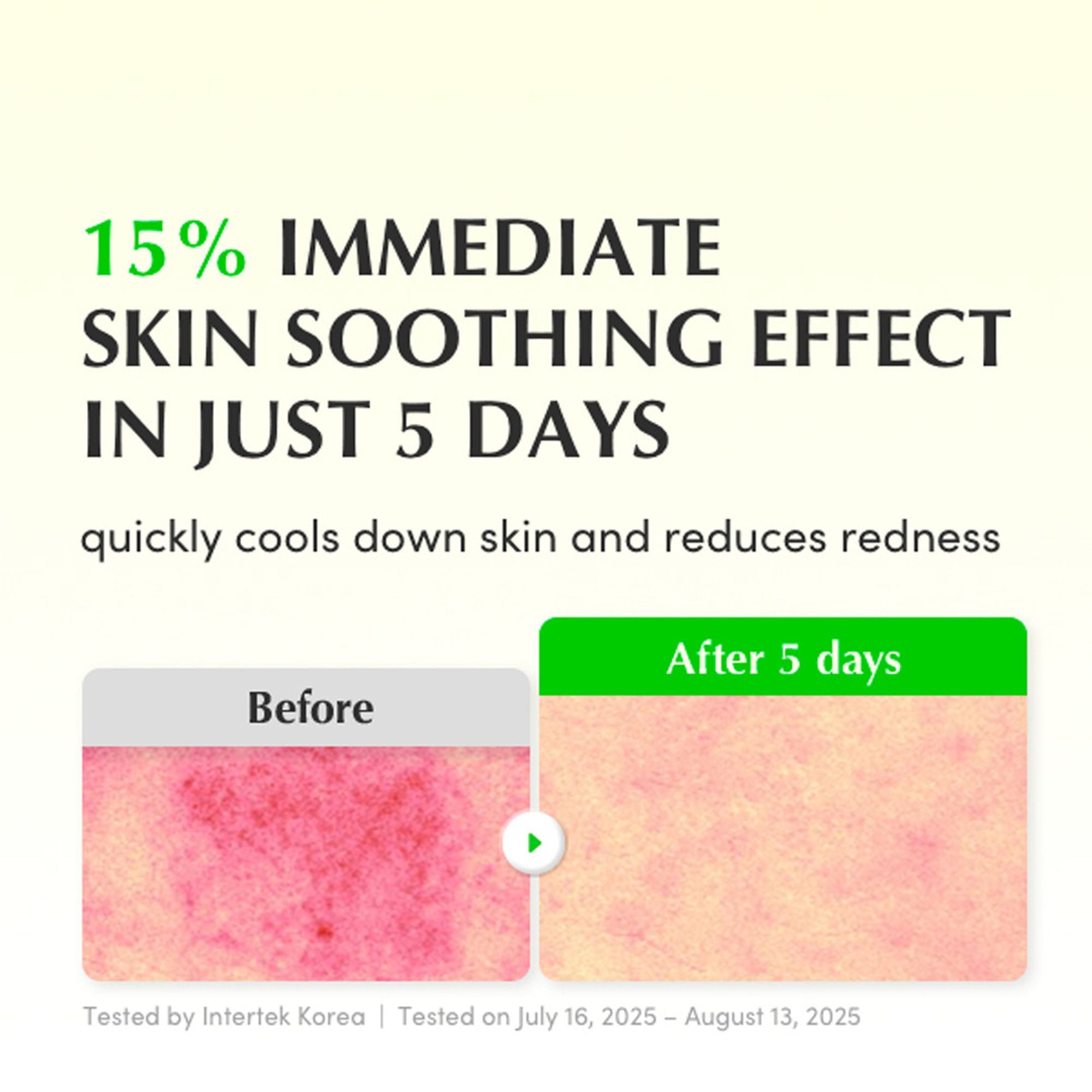 Eqqualberry Aloe PDRN Calming Serum – Cica, Hydrating & Soothing Sensitive Skin | Grocsy