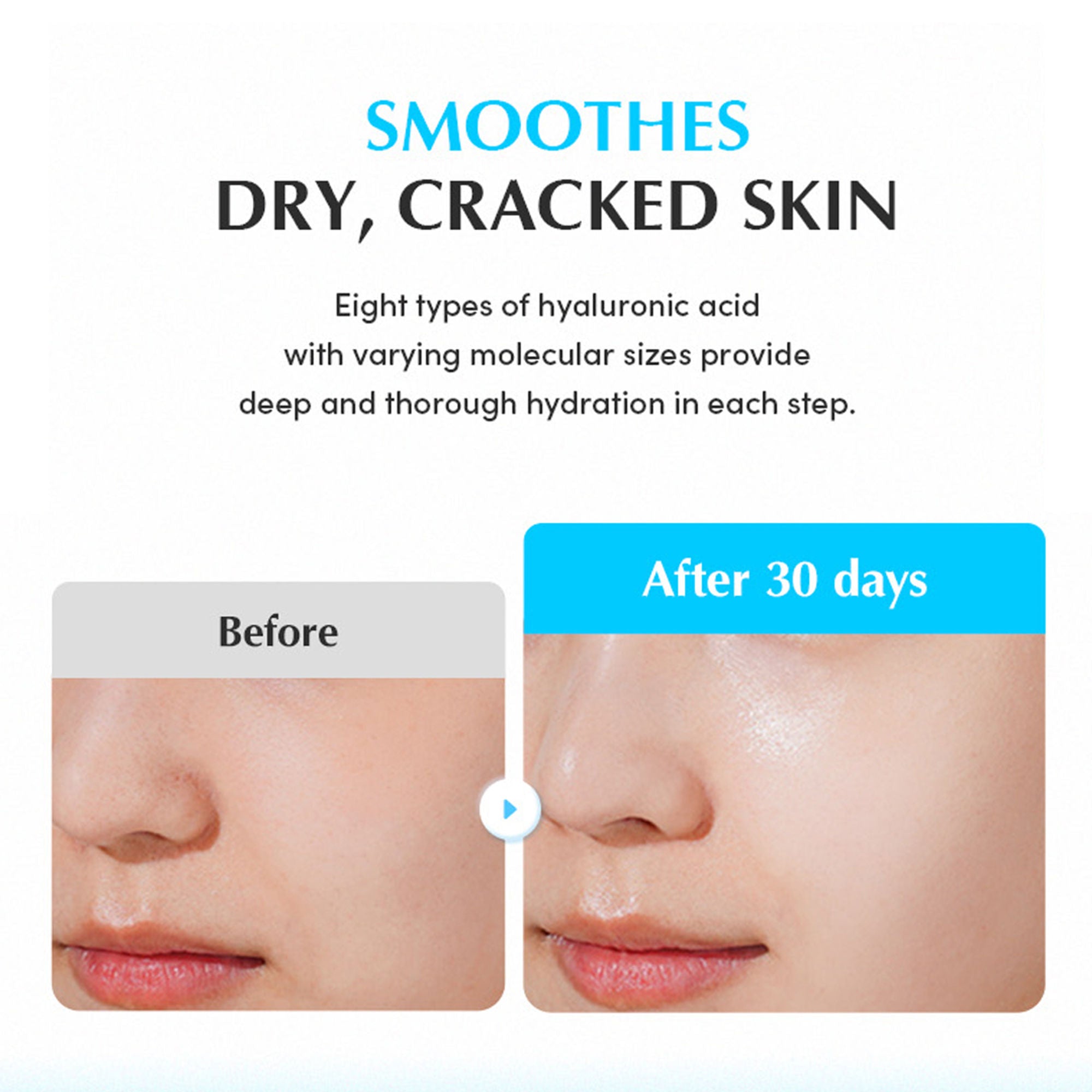 Eqqualberry Swimming Pool Hydrating Ampoule – Glass Skin, 5 Berry Complex & Hyaluronic Acid | Grocsy