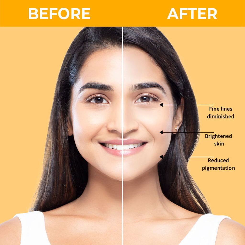Nykaa SkinRX 20% Vitamin C + 1% Hyaluronic Acid Serum for Bright, Radiant and Hydrated Skin | Grocsy