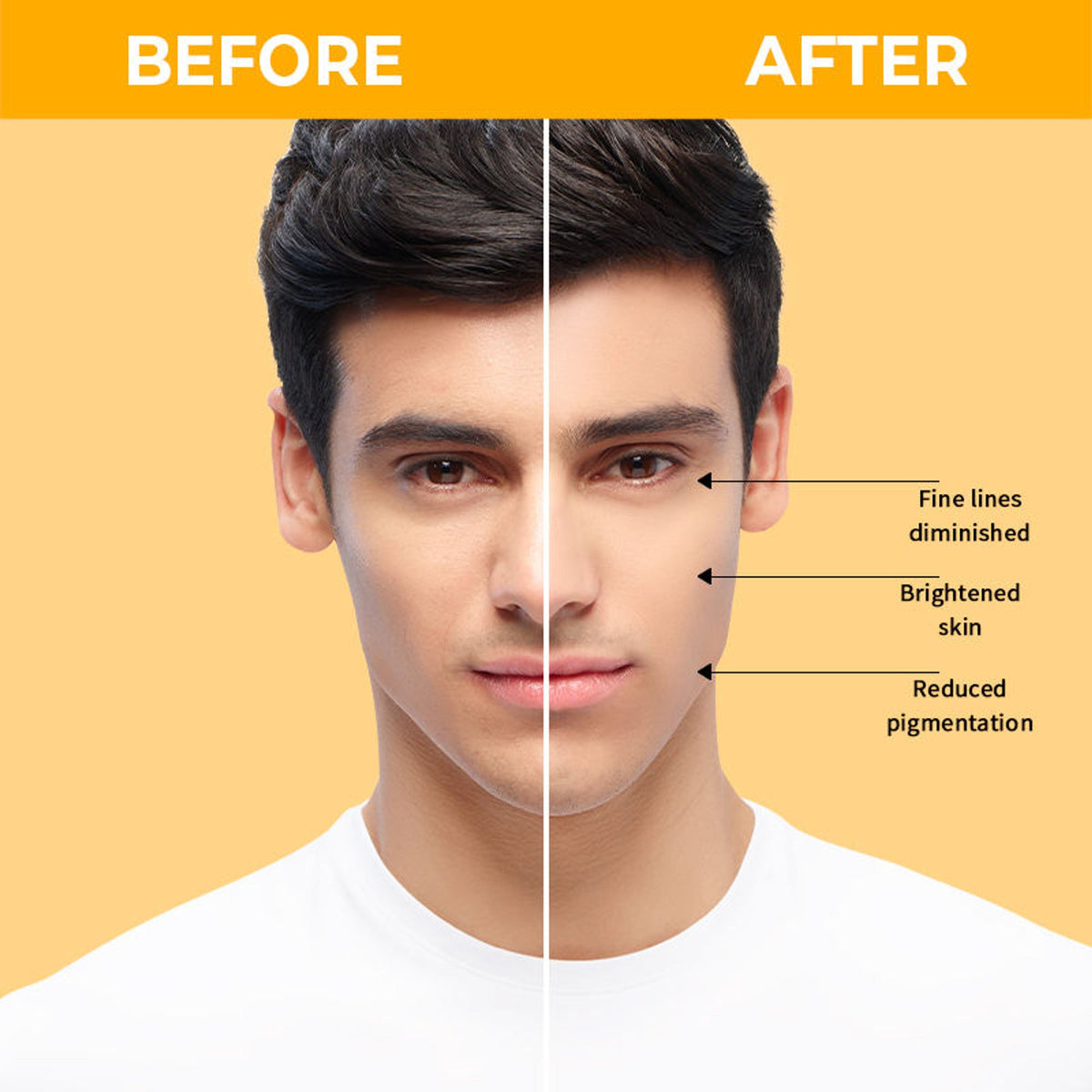 Nykaa SkinRX 20% Vitamin C + 1% Hyaluronic Acid Serum for Bright, Radiant and Hydrated Skin | Grocsy