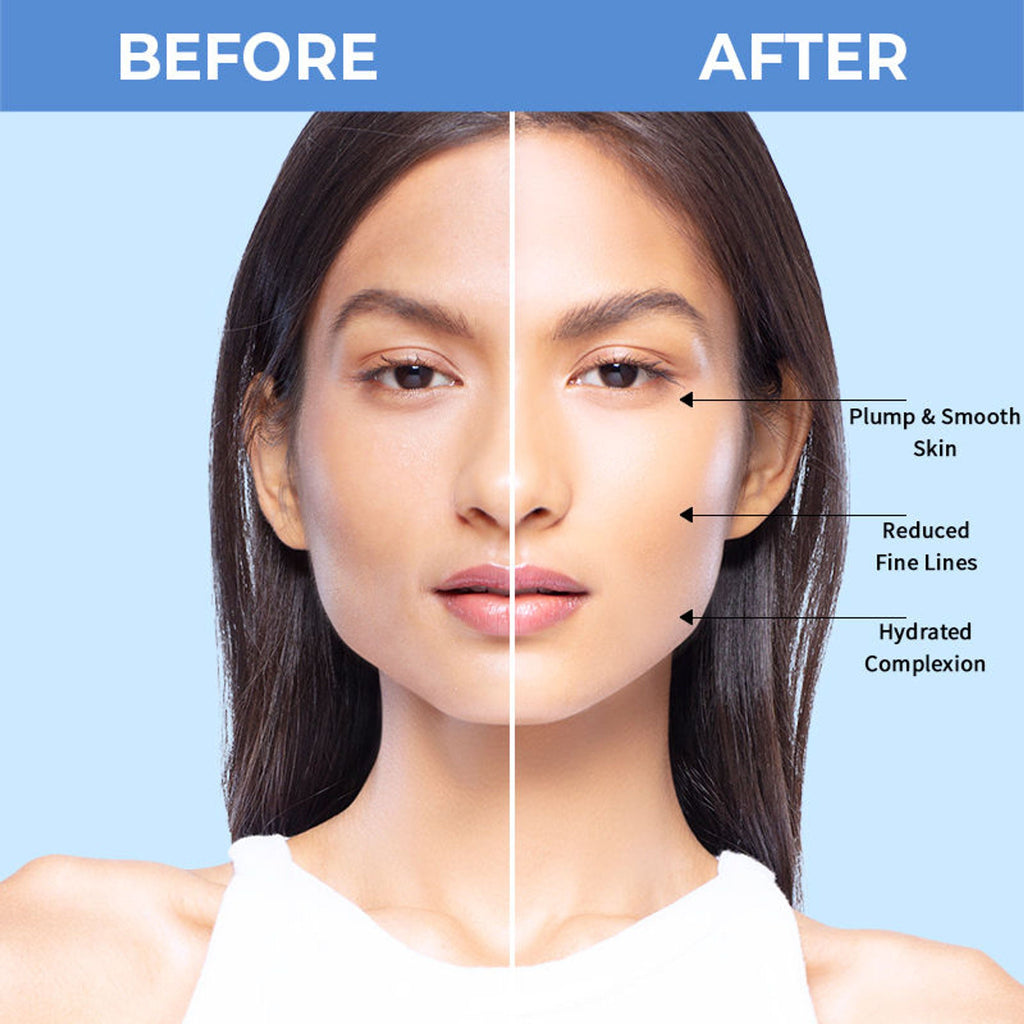 Nykaa SkinRX Hydra X with 2% Hyaluronic Acid + 1% Vitamin B5 Serum for Deep Hydration & Soft Skin | Grocsy