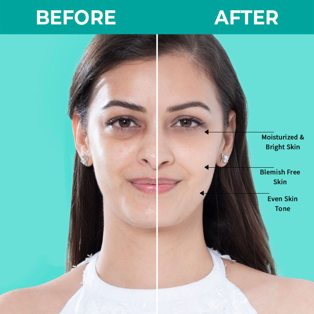 Nykaa SKINRX Spot Corrector with 10% Niacinamide + 1% Zinc Serum to Fade Dark Spots & Pigmentation | Grocsy
