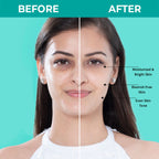 Nykaa SKINRX Spot Corrector with 10% Niacinamide + 1% Zinc Serum to Fade Dark Spots & Pigmentation | Grocsy