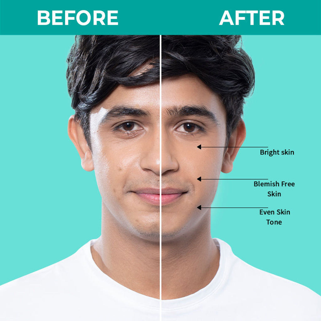 Nykaa SKINRX Spot Corrector with 10% Niacinamide + 1% Zinc Serum to Fade Dark Spots & Pigmentation | Grocsy