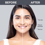 Nykaa SKINRX 2% Salicylic Acid Face Serum | Grocsy