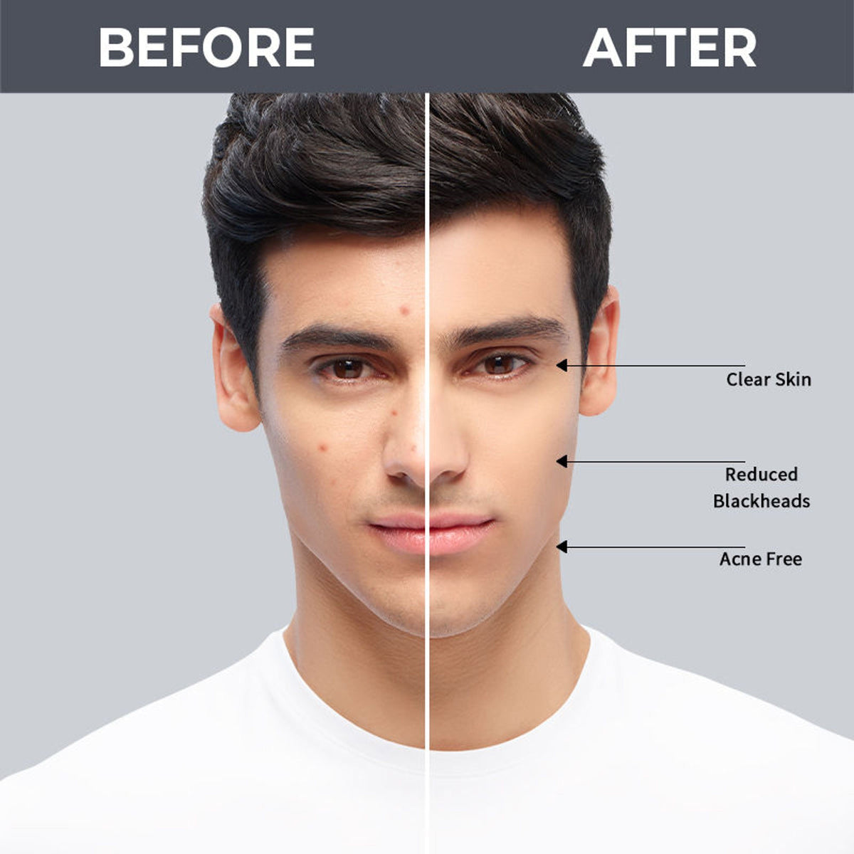Nykaa SKINRX 2% Salicylic Acid Face Serum | Grocsy
