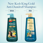 Kesh King Gold Anti-Dandruff Shampoo | Grocsy
