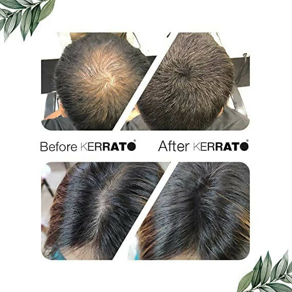 Kerrato Hair Fibres For Thinning Hair (Natural Black) | Grocsy