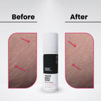 ThriveCo Stretch Marks Expert Serum Cream | Grocsy