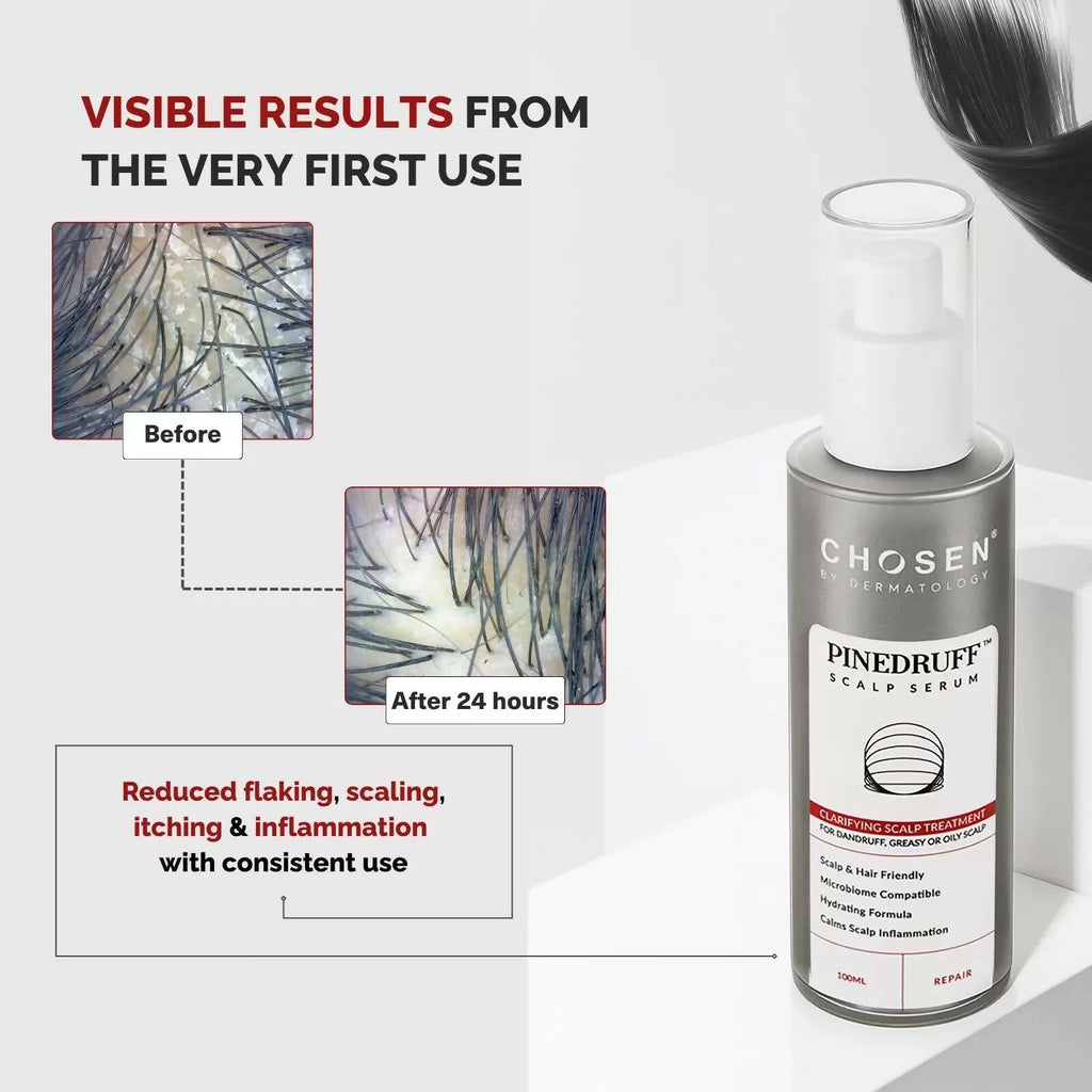 Chosen Pinedruff Scalp Serum Best Dandruff Control Treatment Solution With Pycnogenol | Grocsy