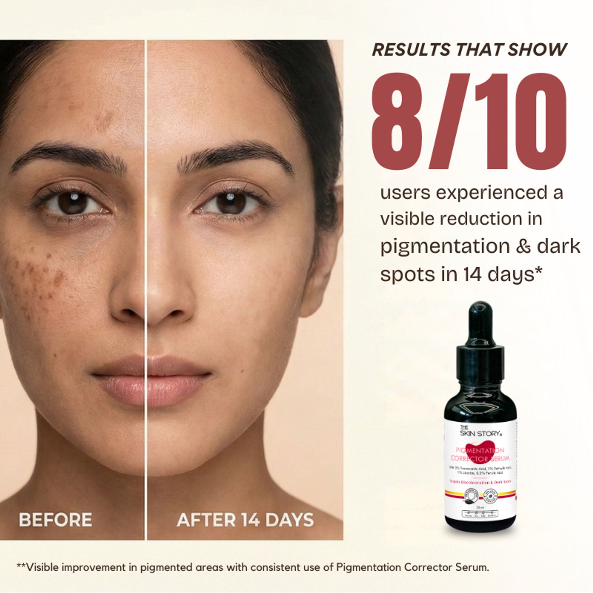 The Skin Story Anti Pigmentation Face Serum For Brighter Skin, Dark Spots, Niacinamide Alpha Arbutin | Grocsy