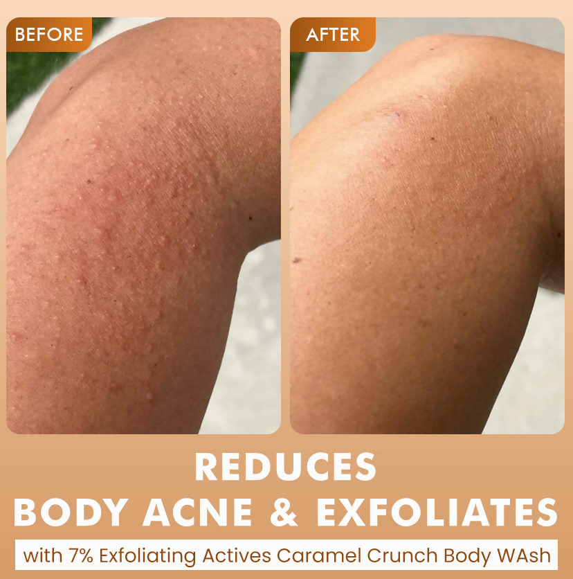 mCaffeine Brighten, De-Tan & Acne-Free Body Wash | Grocsy