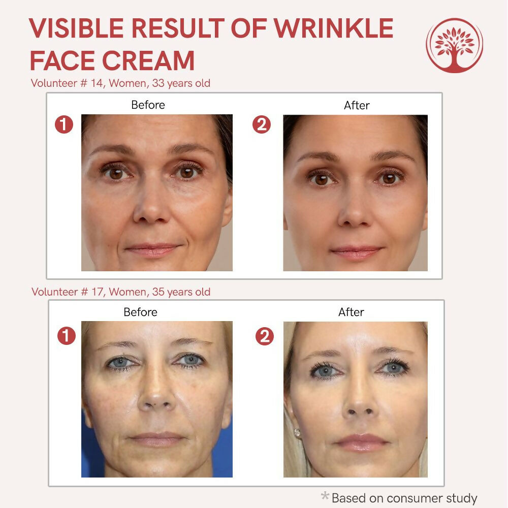Ivory Natural Wrinkle Face Cream For More Radiant And Youthful Look | Grocsy