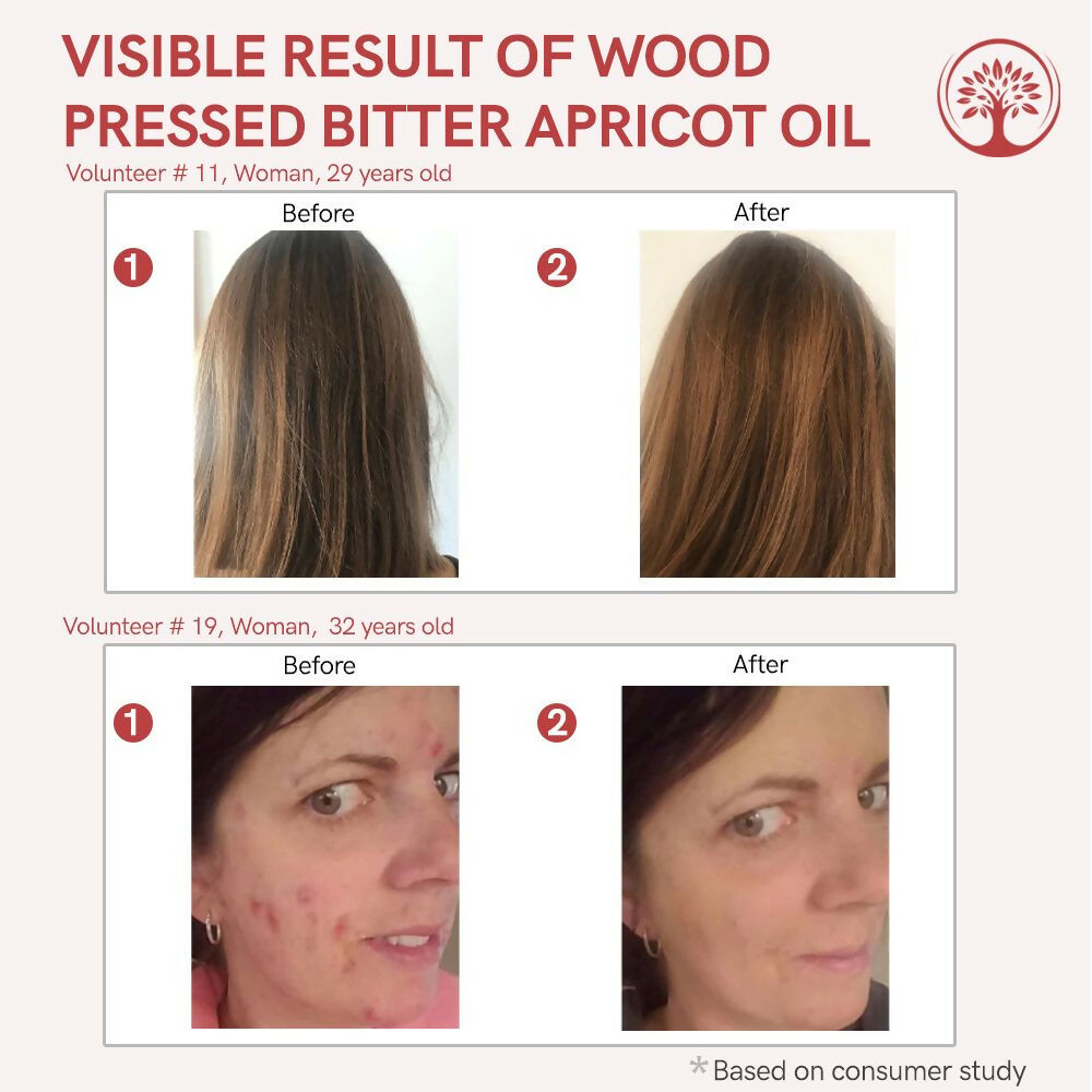 Ivory Natural Wood Pressed Bitter Apricot Oil Organic & Extra Virgin For Deep Moisturization, Gentle Hydration, And Youthful Glow | Grocsy