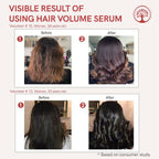 Ivory Natural Hair Volume Serum For Hair Thinning And Healthier Growth | Grocsy