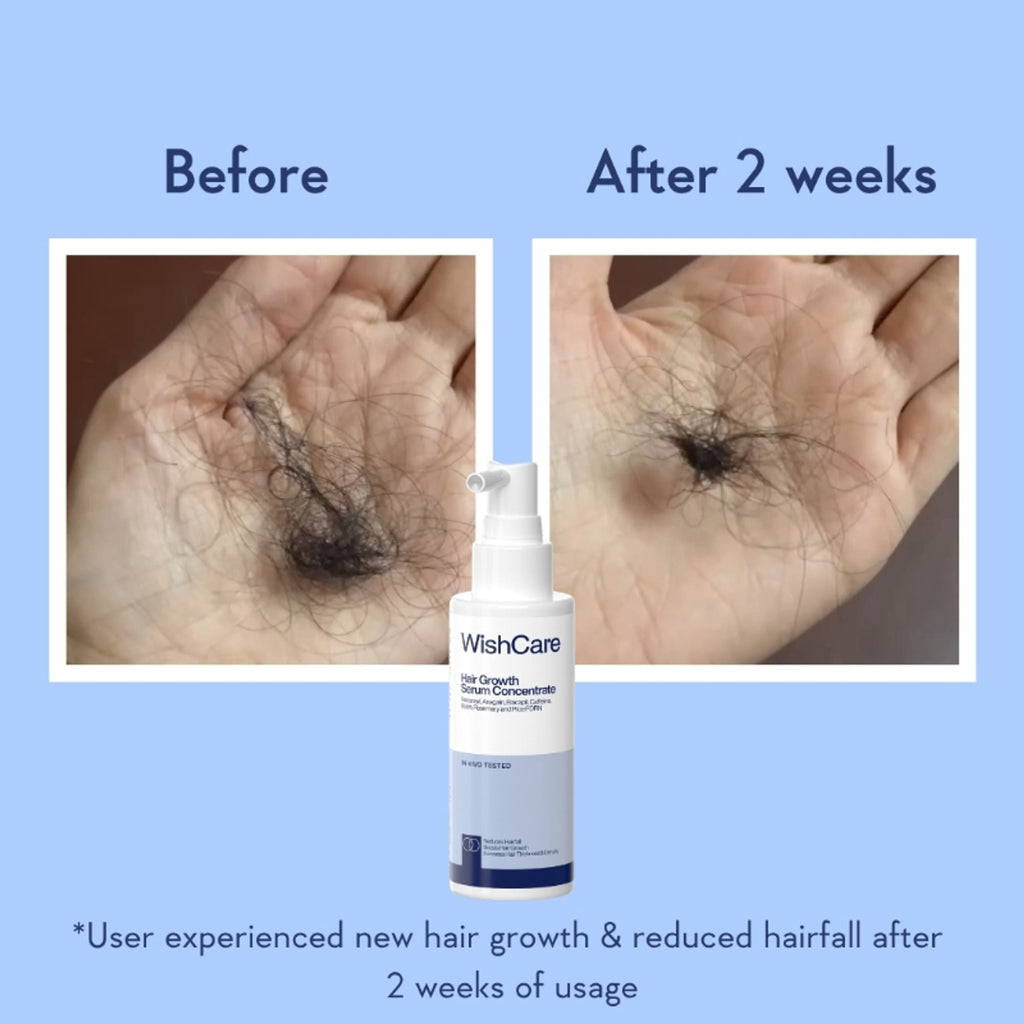 WishCare Hair Growth Serum Concentrate with Redensyl & Rosemary-In-Vivo Tested-Controls Hairfall | Grocsy
