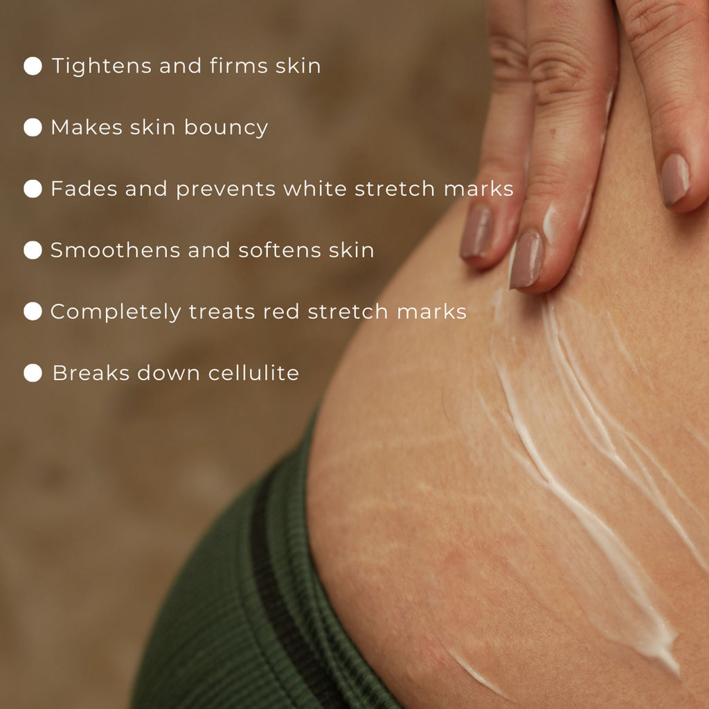 Skinvest Bomb bum cream for Stretch Marks + Cellulite | Grocsy