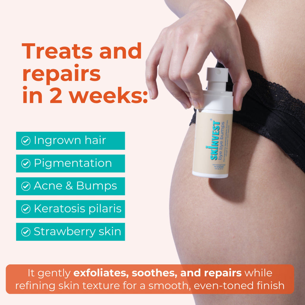 Skinvest Bye Bye Bumps - Exfoliating Body Mist | Grocsy