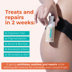 Skinvest Bye Bye Bumps - Exfoliating Body Mist | Grocsy