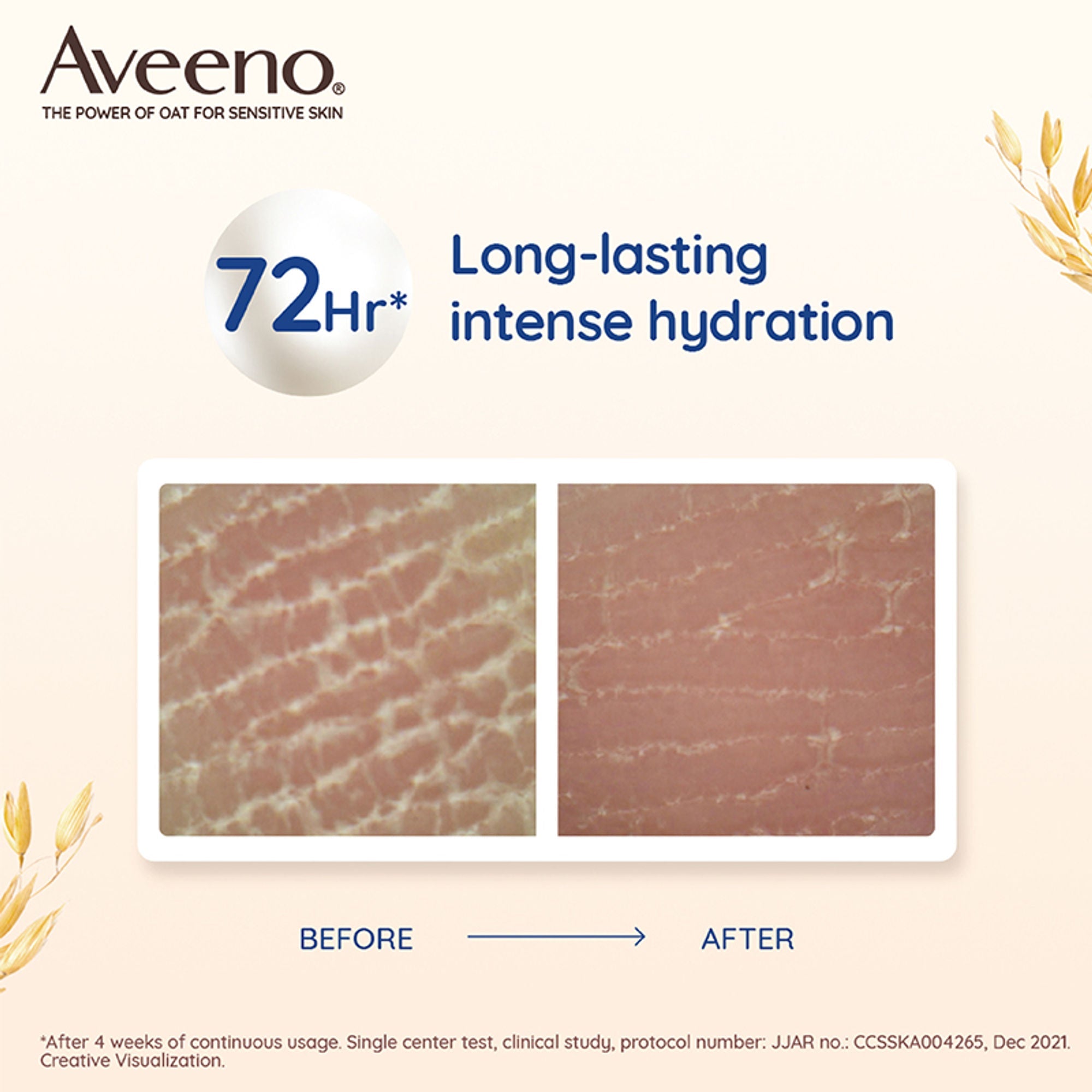 Aveeno Skin Relief Moisturising Lotion - Oat + Shea Butter Body Moisturizer For Dry & Sensitive Skin | Grocsy