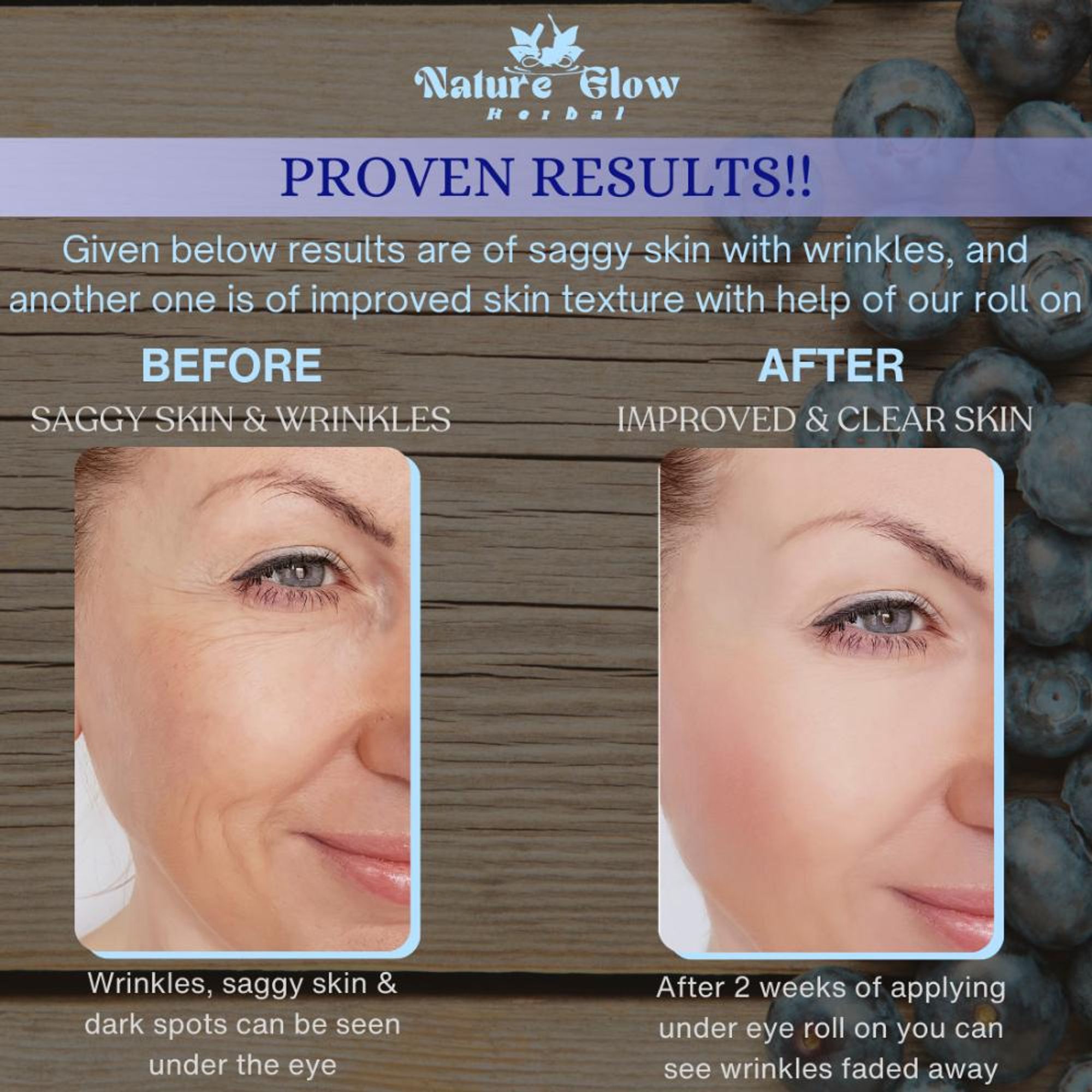 Nature Glow Herbal Under Eye Blueberry Roll On | Grocsy