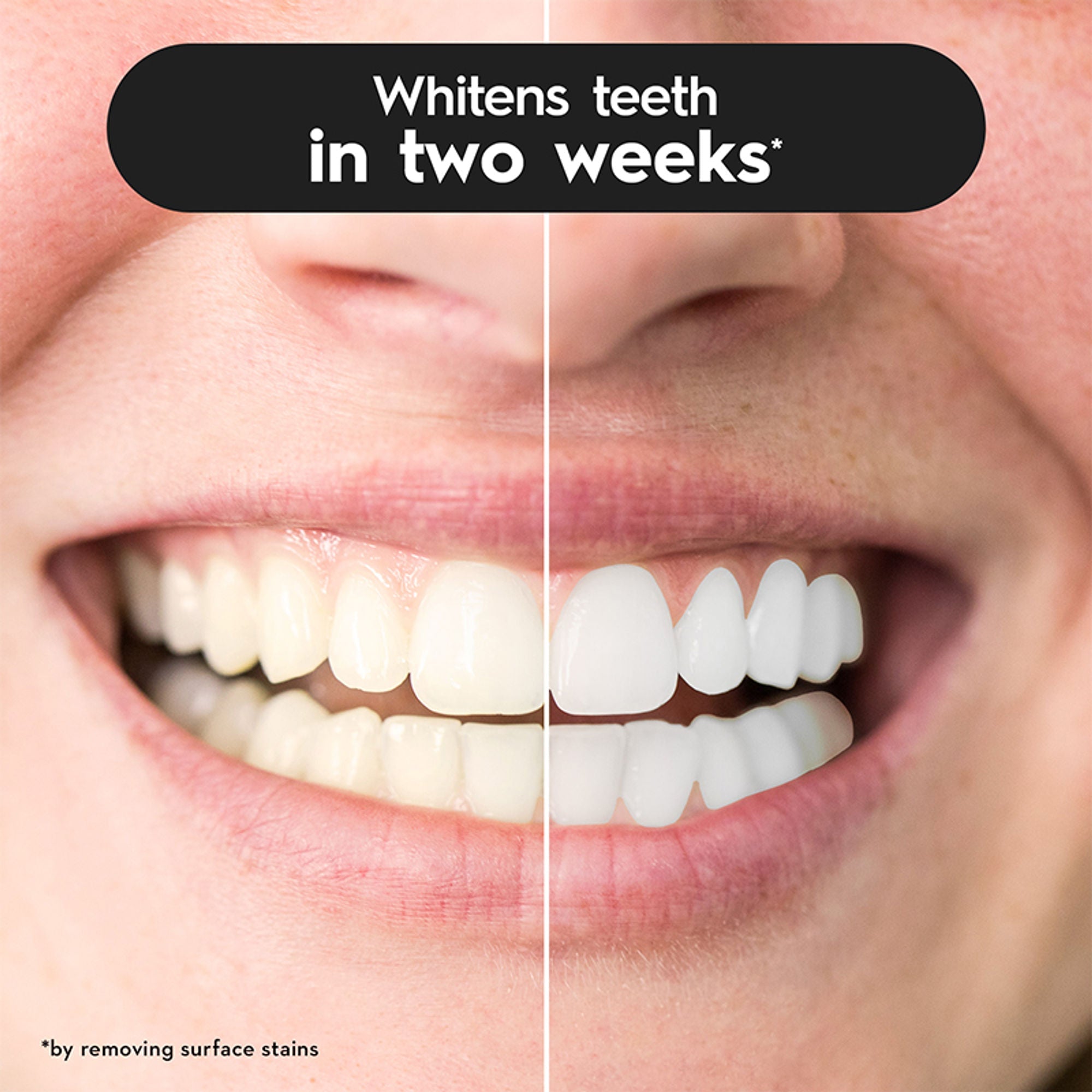 Oral-B 3D White Charcoal Soft Toothbrush For Adults (Pack Of 2) | Grocsy