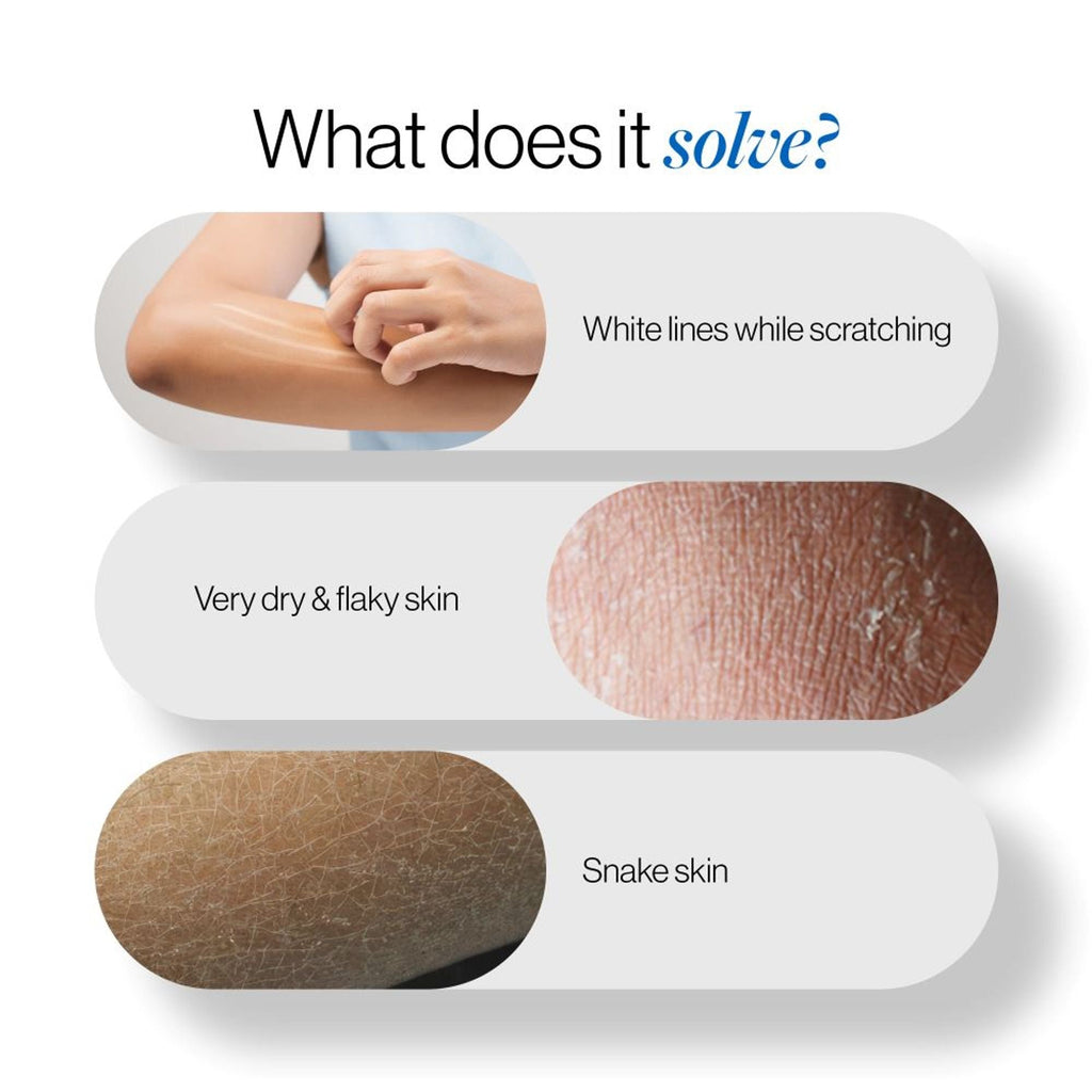 BeBodywise 20% Urea Body Lotion - Advanced Formulation | Grocsy