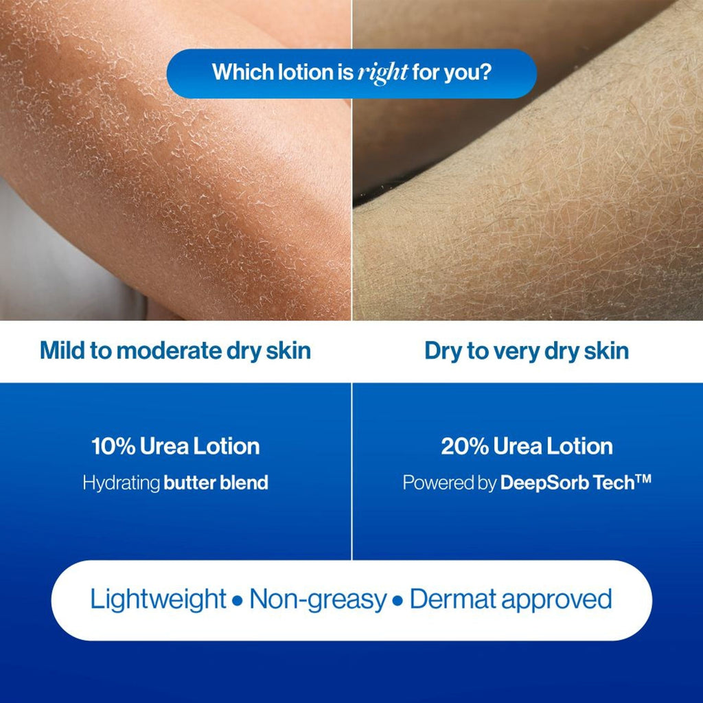BeBodywise 20% Urea Body Lotion - Advanced Formulation | Grocsy