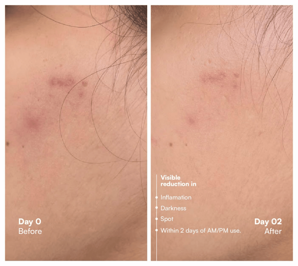Awear Beauty Glass Skin Dual Spot Treatment | Grocsy