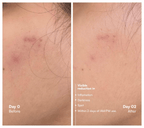 Awear Beauty Glass Skin Dual Spot Treatment | Grocsy