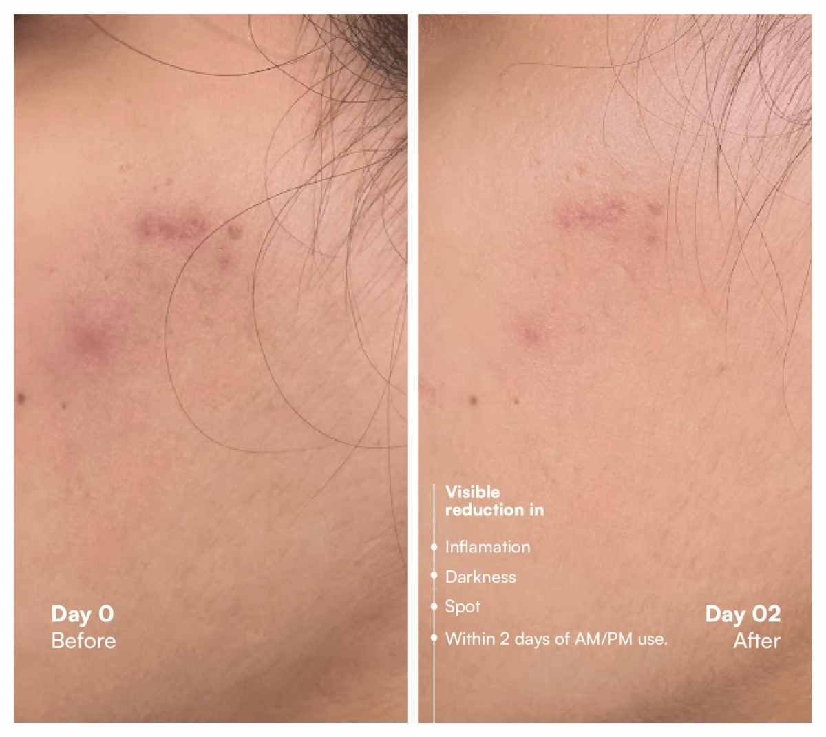 Awear Beauty Glass Skin Dual Spot Treatment | Grocsy