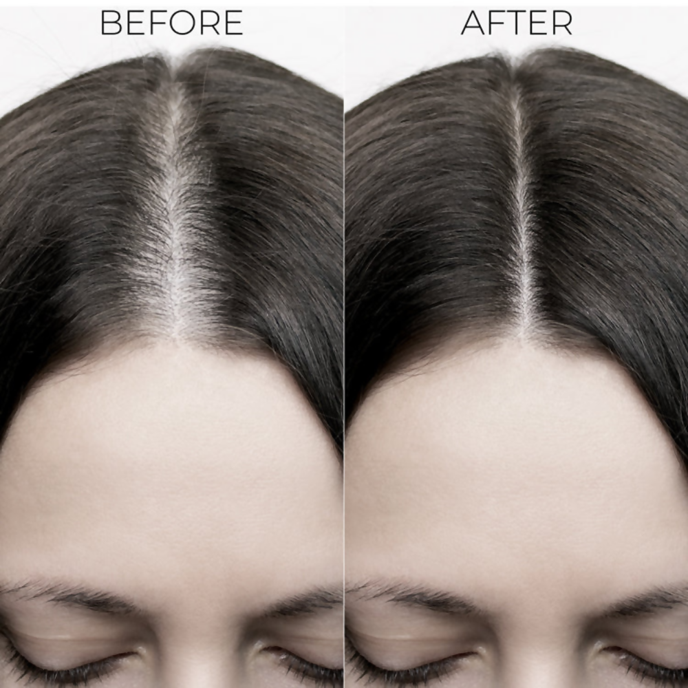 Brillare Ultimate Hair Fall Control kit | Grocsy