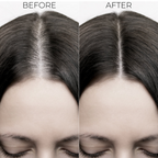 Brillare Ultimate Hair Fall Control kit | Grocsy