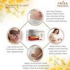 Prisa Organics Stretch Mark Removal Cream To Reduce Stretch Marks, Scars, Spots, Discolouration | Grocsy