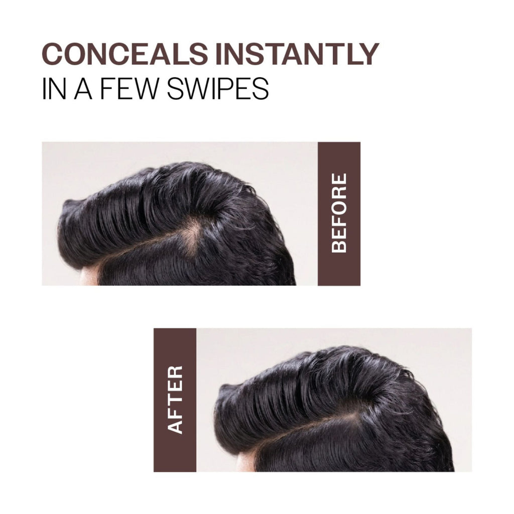 Bare Anatomy Cover-Up Hair Powder 100% Instant Grey Coverage Seamless Natural Finish - Brown | Grocsy