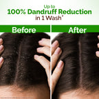 Mamaearth Lemon Anti-Dandruff Shampoo | Grocsy