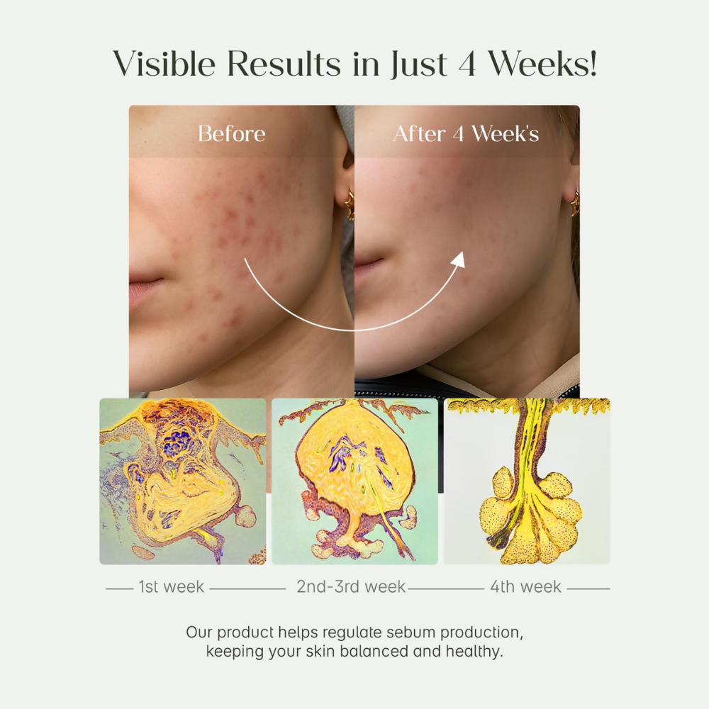 Seoulskin Heartleaf Cleansing Oil | Grocsy