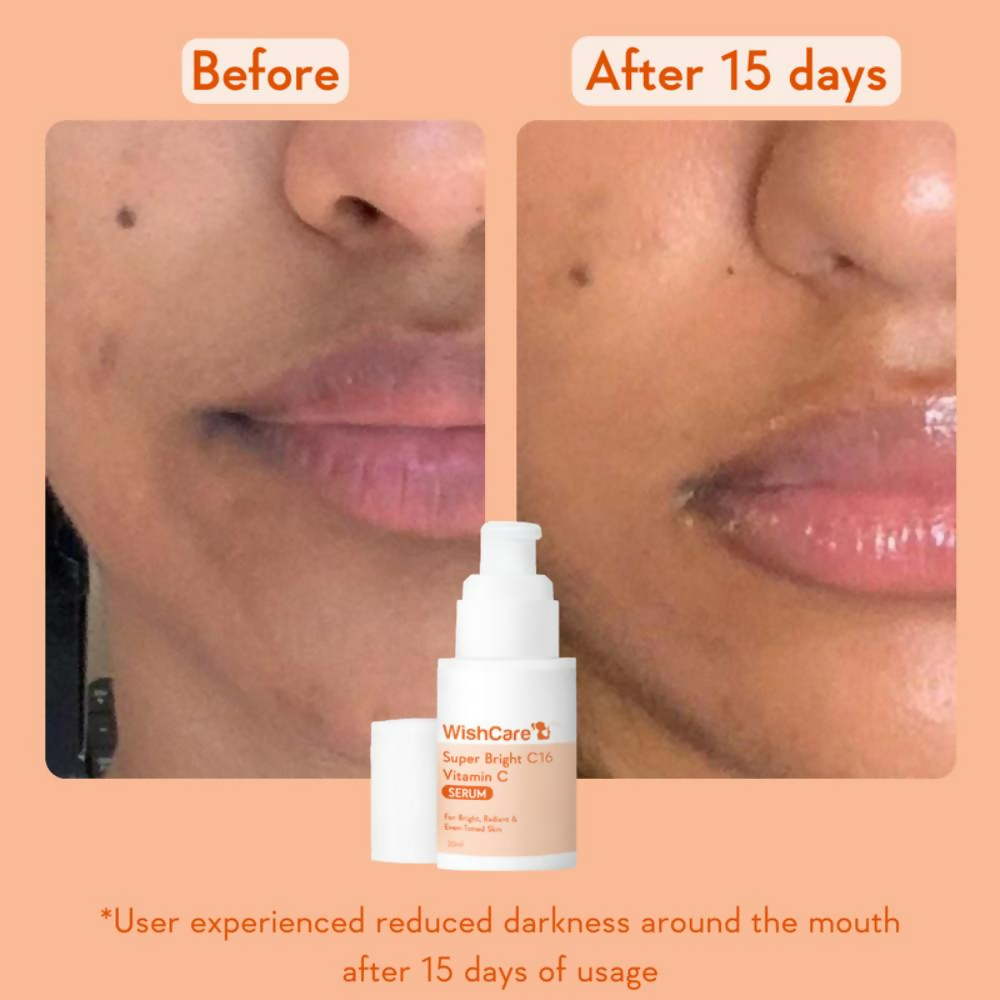 Wishcare Super Bright C16 Vitamin C Face Serum | Grocsy