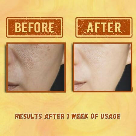 Our Cares Vitamin C Face Cream for Glowing & Clear Skin | Grocsy