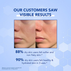 Bella Vita Organic Dry Skin Face Moisturizer | Grocsy