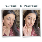 Alps Goodness Diamond Hydrating Facial Kit | Grocsy