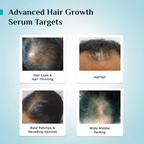 Pilgrim 3% Redensyl, 4% Anagain & 5% Capilia Stem Cell Complex Advanced Hair Growth Serum Roll-On | Grocsy