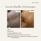 Serumique 23% AHA + 2% BHA + 5% PHA Wash-Off Serum Exfoliator - New You 30% | Grocsy