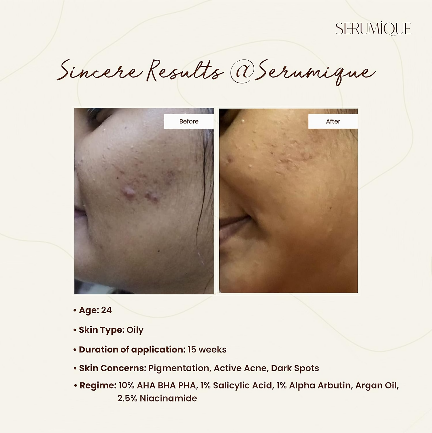 Serumique 23% AHA + 2% BHA + 5% PHA Wash-Off Serum Exfoliator - New You 30% | Grocsy
