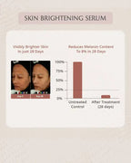 AreoVeda Skin Brightening Serum | Grocsy